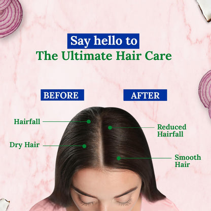 Parachute Onion Enriched Coconut Hair Oil